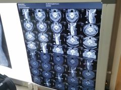 -张钰强中医正骨推拿连锁(华发商都店)