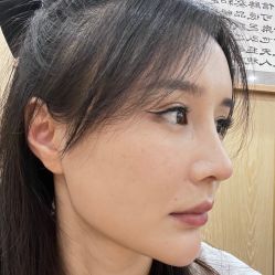 体验前-紫洁俪方（北京）医疗美容