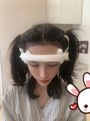 -大麦微针植发丨全国连锁