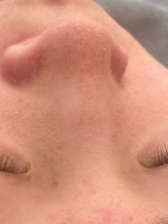 -skin79皮肤管理中心