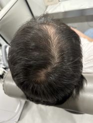 -熙朵美学植发·连锁品牌