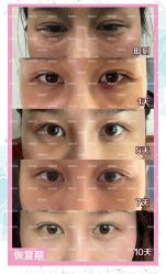 -南京健丽·去眼袋医疗美容机构