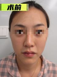 -素美医疗美容·西南眼鼻整形·修复基地