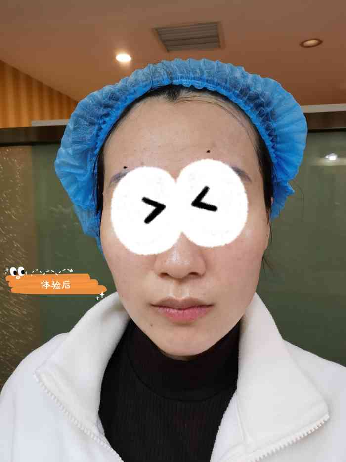 天津伊美尔医疗整形美容专科医院-"【项目】水光针来过很多次了,服务