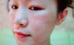 点击看大图 -SKINIST丽铂医疗美容