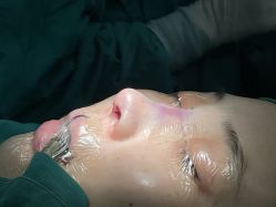 -北京米扬丽格医疗美容·联合丽格鼻整形中心