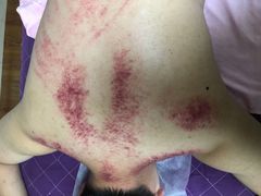 -沈师傅盲人按摩工作室(密三小区店)