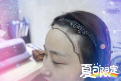 -大麦微针植发全国连锁