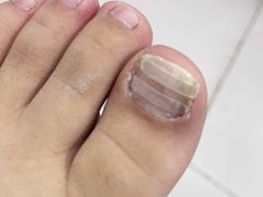 -新甲连锁灰指甲·甲沟炎·鸡眼(黑龙江路店)