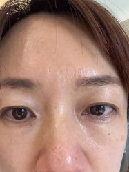 体验后-云南吴氏嘉美医疗美容医院