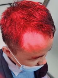 -雍禾植发全国连锁