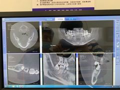 -Dr.Z dental仁康种植矫正中心