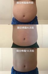 -HYOUNG 禾漾·BTL官方美学中心