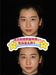 -广东韩妃整形外科医院