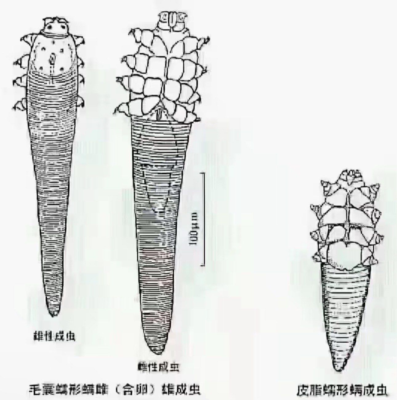 拜拜,烦恼的螨虫