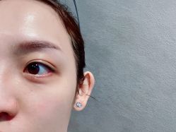 体验后-和颜一美轻医美连锁