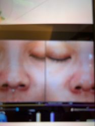 -苑苑vbeauty科技美容SPA
