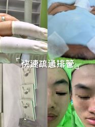 -苗医生0感祛痘连锁