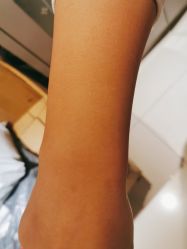 -薇兰专业脱毛连锁机构