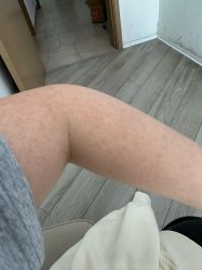 -HEYAN荷妍专业脱毛连锁机构