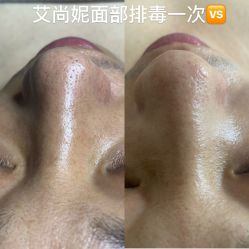 -艾尚妮·美容美体SPA