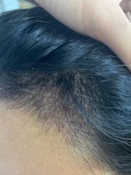 点击看大图 -熙朵美学植发·连锁品牌