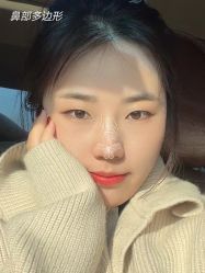 -北京米扬丽格医疗美容·联合丽格鼻整形中心