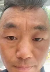 -北京美痣堂古方祛痣斑疣瘊