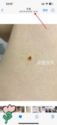 -深圳阳光医疗美容医院·旗舰店