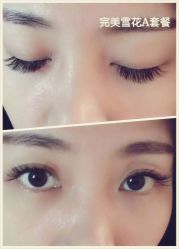 睫毛嫁接-光SPA科技美肤