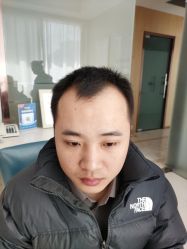 -大麦微针植发丨全国连锁