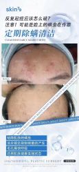 -skin79皮肤管理中心