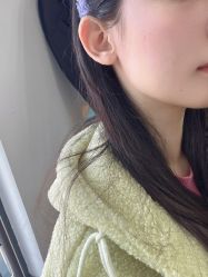 体验后-上海星和医疗美容
