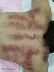 -苑苑vbeauty科技美容SPA