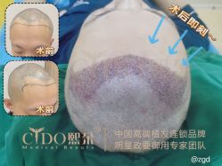 -熙朵美学植发·连锁品牌