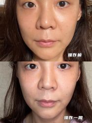 -新美荟医美·专注面部美学抗衰