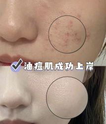 -SKIN79皮肤管理中心
