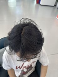 -大麦微针植发全国连锁