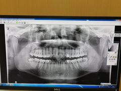 -同步齿科·数字化正畸种植口腔中心(珠海店)