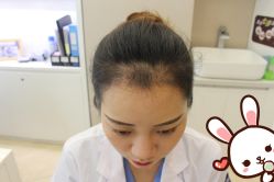 点击看大图 -大麦微针植发丨全国连锁