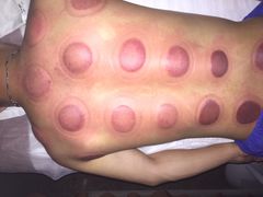 -智慧盲人按摩艾灸-颈肩腰膝疼痛调理(浦东店)