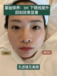 -美愈美肤MEIYU SKIN