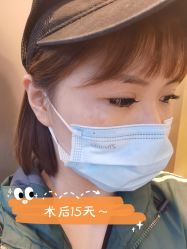 点击看大图 -Yestar宁波艺星整形医院
