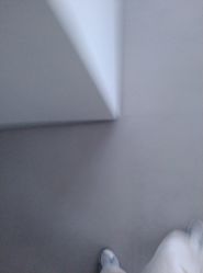 -颜蕾医美·黄金微针·水光·玻尿酸·超声炮