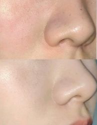 -苗方清颜痘肌研究所