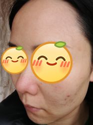 体验后-成都艾特他整形外科医院