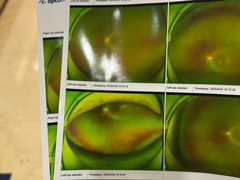 -昆明爱尔眼科医院