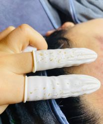 -成都苗方清颜专业祛痘
