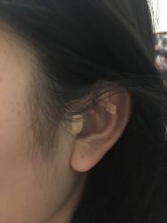 -肥三针腧穴瘦身馆