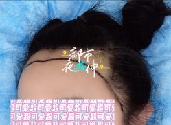 -大麦微针植发全国连锁